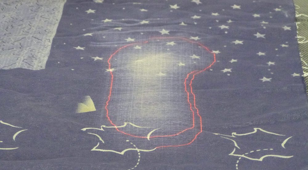 2-laser